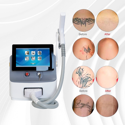 Q Switch Nd YAG Laser Machine Απομάκρυνσης Τατουάζ 1064nm 532nm 1320nm 2 χρόνια εγγύηση