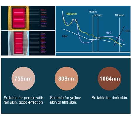 Μηχανή αποτρίχωσης χωρίς πόνο 755nm 940nm 1064nm