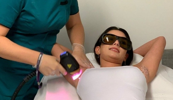 808nm Diode Laser Hair Removal Machine TUV ISO CE Πιστοποίηση για την αφαίρεση των πορών