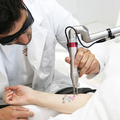 Μηχανή απομάκρυνσης τατουάζ με laser μίας δευτερόλεπτης σε σταθερό στυλ