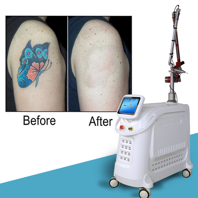 1064nm Q Switched Nd Yag Laser Picosecond Μηχανή Απομάκρυνσης Τατουάζ Σταθερό στυλ