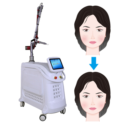 Μηχανή λέιζερ Pico 532nm 1064nm 755nm Q Switch Nd YAG Laser Equipment