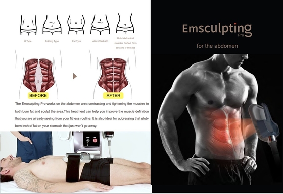 Εμπορική EMS Slimming Machine 10 ιντσών αφής οθόνη για το σαλόνι ομορφιάς / spa