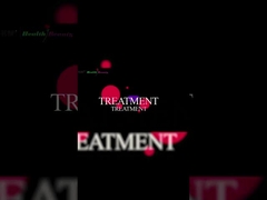 Αποτελεσματικό 808nm±5nm μήκος κύματος Weifang KM Ηλεκτρονική Διοδίου Laser αποτρίχωση για ιατρική