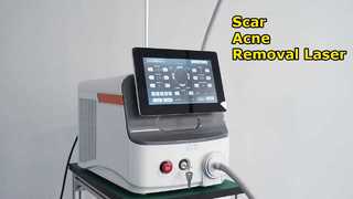 Fractional CO2 Laser Scar Scar Acne Resurfacing Skin Resurfacing